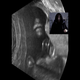 Illustration for article titled This Unborn Baby Looks Exactly Like Emperor Palpatine